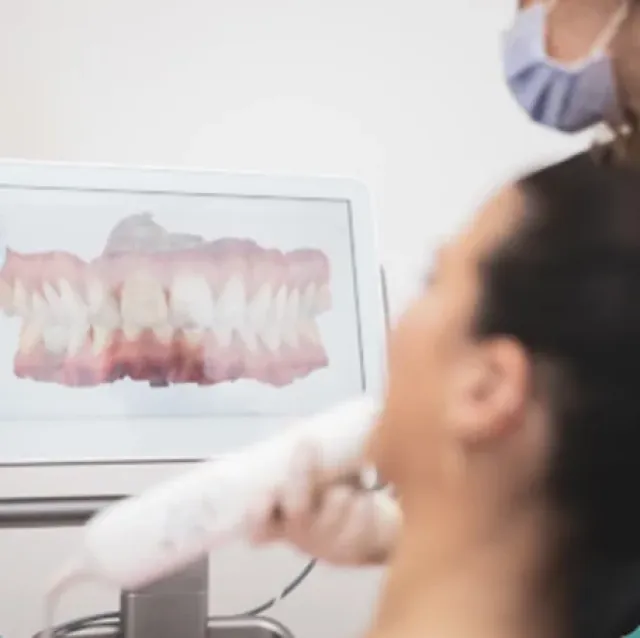 Intraoralscanner